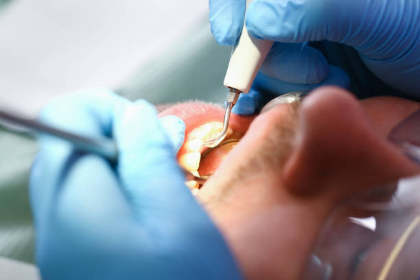 Best Emergency TMJ Treatment in Chantilly, VA
