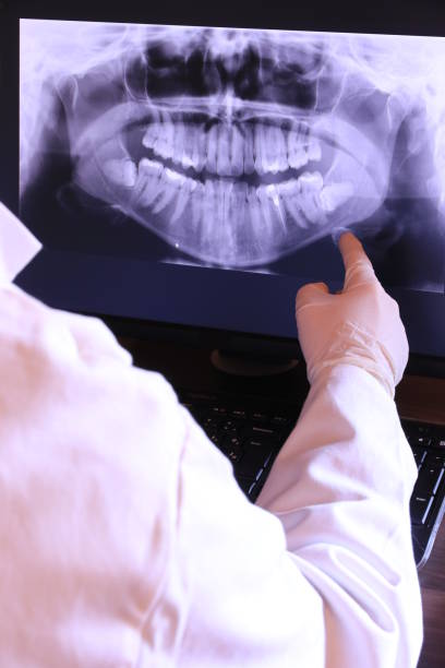 Best Emergency Tooth Extraction in Chantilly, VA